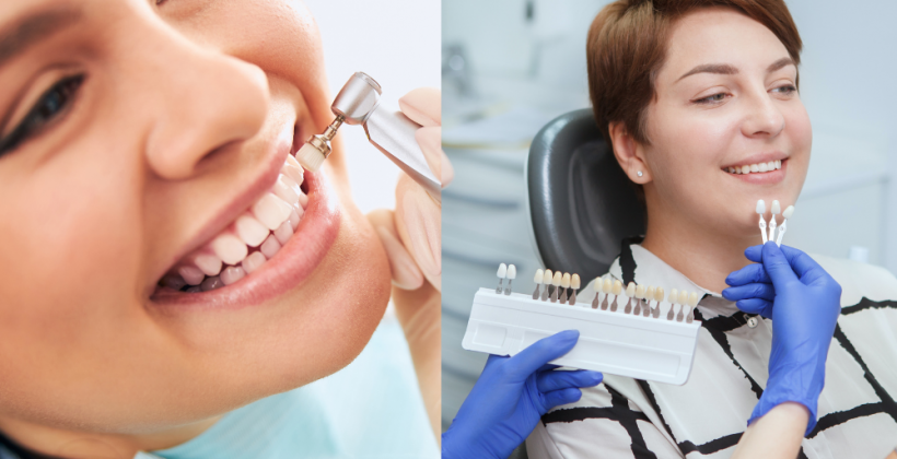 What is the Difference Between Teeth Cleaning and Whitening? What is the Difference Between Teeth Cleaning and Whitening?