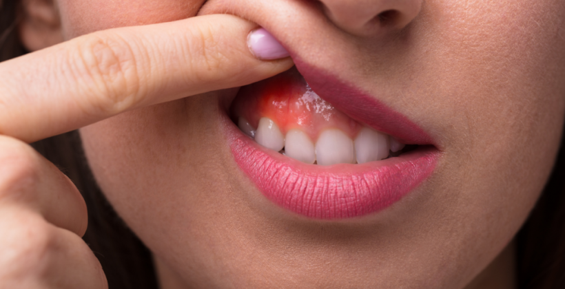 Can a Periodontist Fix Gums? Can a Periodontist Fix Gums?