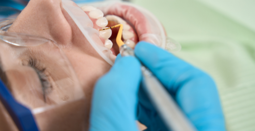 Is Scaling and Polishing Good for Teeth? Is Scaling and Polishing Good for Teeth?