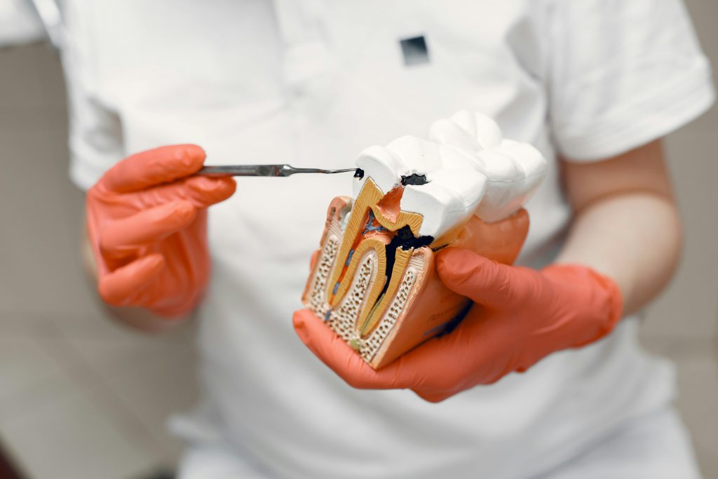 Dentist holding a tooth model and pointing at the root canal area with a dental tool