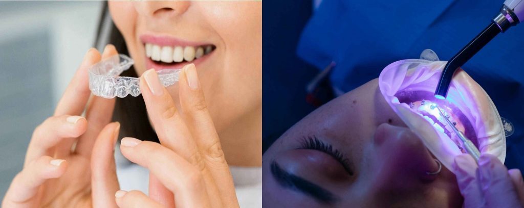 Braces vs Invisalign