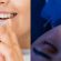 Teeth Braces vs Invisalign: Which Is Right for Your Smile?