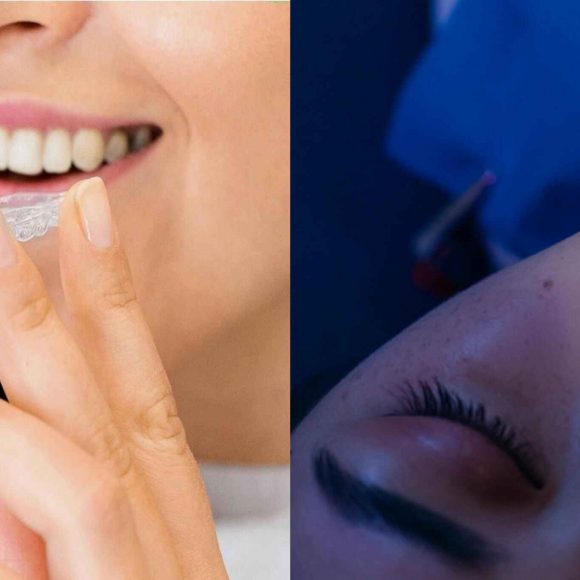 Teeth Braces vs Invisalign: Which Is Right for Your Smile?