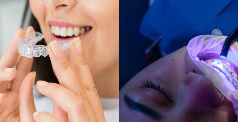 Teeth Braces vs Invisalign: Which Is Right for Your Smile?
