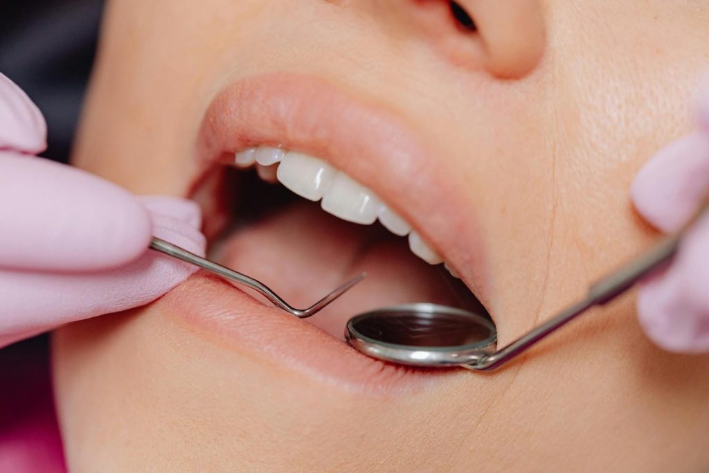 Dentist performing professional teeth cleaning with dental tools