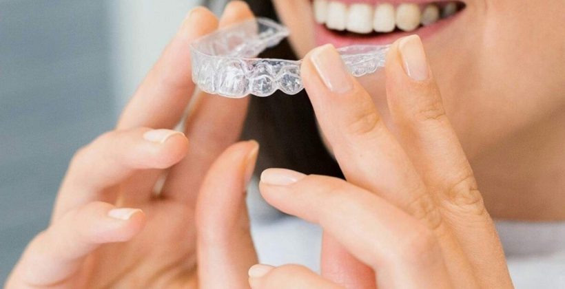 The Ultimate Guide to Invisalign in Abu Dhabi: Costs, Process, and Results