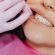 Can Invisalign Fix An Overbite? (What It Can Do, What It Can’t, And What To Expect)