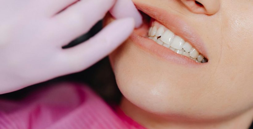 Can Invisalign Fix An Overbite? (What It Can Do, What It Can’t, And What To Expect)